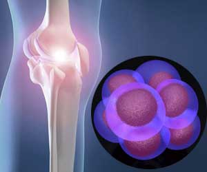 stem-cell-osteoarthritis-knee